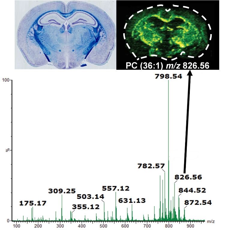 Molecular image of phospholipids

          in a coronal section of mouse brain