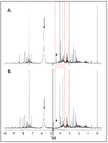 Comparison of 1H-NMR spectra of human urine samples using
        identical parameters settings without calibration
