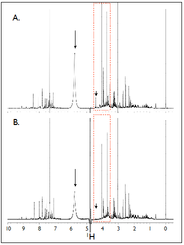 Comparison of 1H-NMR spectra of human urine samples using
        identical parameters settings without calibration