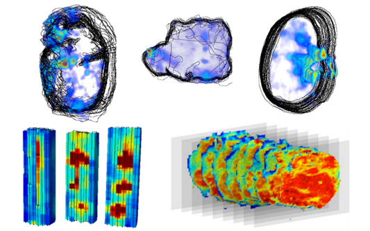 MS imaging examples